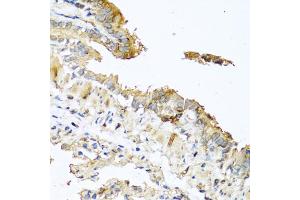 Immunohistochemistry of paraffin-embedded mouse lung using RNASE11 antibody (ABIN5970447) at dilution of 1/100 (40x lens). (RNASE11 抗体)