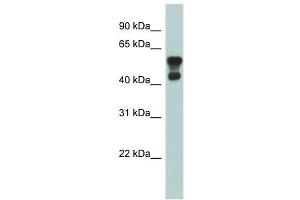 PAFAH1B1 antibody used at 1 ug/ml to detect target protein. (PAFAH1B1 抗体  (N-Term))