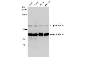 WB Image Various whole cell extracts (30 μg) were separated by 5% SDS-PAGE, and the membrane was blotted with ADAR1 antibody [N3C1], Internal , diluted at 1:1000. (ADAR 抗体)