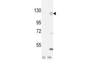 Western blot analysis of FGFR antibody and 293 cell lysate (2 ug/lane) either nontransfected (Lane 1) or transiently transfected with the FGFR1 gene (2). (FGFR1 抗体  (AA 132-161))