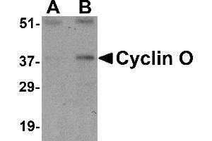 Western blot analysis of UNG2 in mouse bladder tissue lysate with UNG2 antibody at (A) 0.