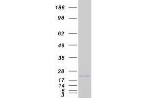 Western Blotting (WB) image for Cytochrome B5 Type B (Outer Mitochondrial Membrane) (CYB5B) protein (Myc-DYKDDDDK Tag) (ABIN2712811)