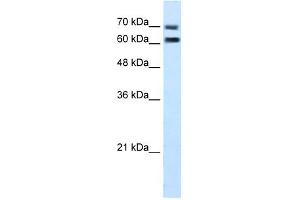 FAM55D antibody used at 5 ug/ml to detect target protein. (FAM55D 抗体  (C-Term))