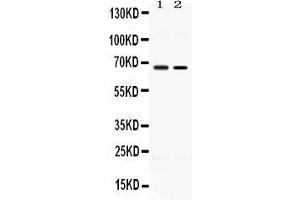 Western blot analysis of ACCN1 expression in rat testis extract ( Lane 1) and MCF-7 whole cell lysates ( Lane 2). (ACCN1 抗体  (N-Term))