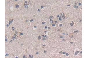 Detection of TGFb3 in Human Cerebrum Tissue using Polyclonal Antibody to Transforming Growth Factor Beta 3 (TGFb3)