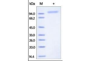 Human Cadherin-6, His Tag on SDS-PAGE under reducing (R) condition. (CDH6 Protein (AA 19-615) (His tag))