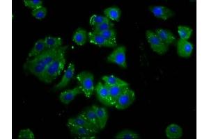 Immunofluorescence staining of HepG2 cells with ABIN7165895 at 1:133, counter-stained with DAPI. (ODR4 抗体  (AA 153-251))