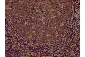 Immunohistochemistry (IHC) image for anti-CD44 (CD44) (AA 21-220) antibody (ABIN7147160)