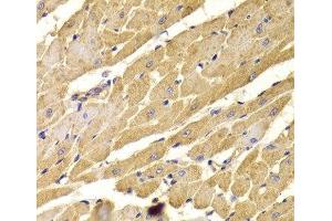 Immunohistochemistry of paraffin-embedded Rat heart using PEX5 Polyclonal Antibody at dilution of 1:100 (40x lens). (PEX5 抗体)