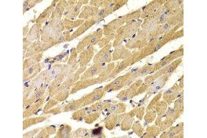 Immunohistochemistry of paraffin-embedded Rat heart using PEX5 Polyclonal Antibody at dilution of 1:100 (40x lens). (PEX5 抗体)