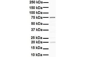 Western Blotting (WB) image for anti-DEAD (Asp-Glu-Ala-Asp) Box Polypeptide 41 (DDX41) (N-Term) antibody (ABIN2775230)