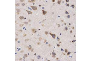 Immunohistochemistry (Paraffin-embedded Sections) (IHC (p)) image for anti-Karyopherin (Importin) alpha 4 (KPNA4) (AA 1-240) antibody (ABIN3015855)
