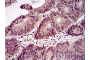 Image no. 3 for anti-BPI Fold Containing Family B, Member 1 (BPIFB1) (AA 248-475) antibody (ABIN1502165)