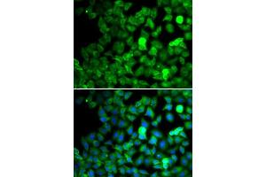 Immunofluorescence analysis of MCF-7 cells using SARS antibody. (Seryl-tRNA Synthetase (SARS) (AA 1-300) 抗体)