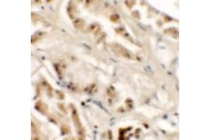 Immunohistochemistry of GZF1 in human kidney tissue with GZF1/ZNF336 Antibody at 2. (ZNF336 抗体  (C-Term))