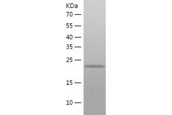 EMG1 Protein (AA 1-244) (His tag)