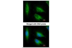 ICC/IF Image Immunofluorescence analysis of paraformaldehyde-fixed HeLa, using EEF1E1, antibody at 1:200 dilution. (EEF1E1 抗体)