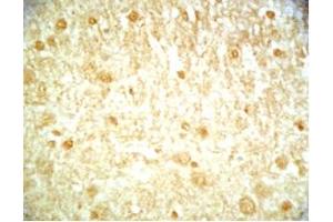 Mouse brain tissue was stained by Rabbit Anti-Metasin (1-25) (Human) / KISS-1 (68-92) (Human) Serum (KISS1 抗体  (AA 1-25, AA 68-92))