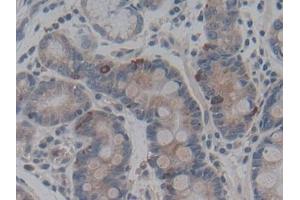 Immunohistochemistry (IHC) image for anti-ATP-Binding Cassette, Sub-Family C (CFTR/MRP), Member 2 (ABCC2) (AA 1300-1534) antibody (ABIN7441076)