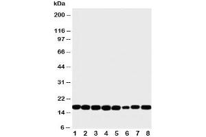 Western blot testing of NM23 antibody and rat samples 1: heart;  2: brain;  3: liver;  4: skeletal muscle; and human samples 5: PANC;  6: HeLa;  7: SKOV;  8: COLO320 cell lysate (NME1 抗体  (C-Term))