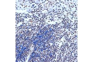 Immunohistochemistry of paraffin-embedded human appendix using A Rabbit mAb (ABIN7265387) at dilution of 1:100 (40x lens). (BAF53A 抗体)