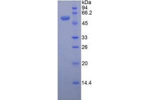 SDS-PAGE analysis of Mouse ENPP1 Protein. (ENPP1 蛋白)