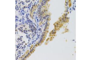 Immunohistochemistry (Paraffin-embedded Sections) (IHC (p)) image for anti-Kinesin Family Member 1B (KIF1B) (AA 1501-1770) antibody (ABIN6142861)