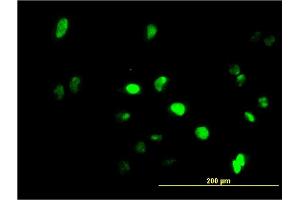 Immunofluorescence of monoclonal antibody to GFI1 on HeLa cell. (GFI1 抗体  (AA 1-91))