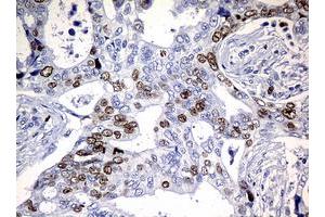 Image no. 5 for anti-Antigen Identified By Monoclonal Antibody Ki-67 (MKI67) (AA 1160-1493) antibody (ABIN1490857) (Ki-67 抗体  (AA 1160-1493))