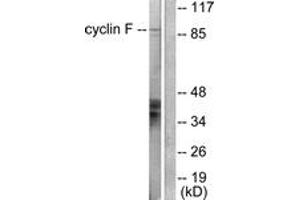Western blot analysis of extracts from HeLa cells, using Cyclin F Antibody. (Cyclin F 抗体  (AA 737-786))