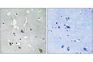 Immunohistochemistry analysis of paraffin-embedded human brain, using TIRAP (Phospho-Tyr86) Antibody. (TIRAP 抗体  (pTyr86))