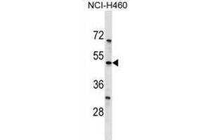 Western Blotting (WB) image for anti-Potassium Channel, Subfamily K, Member 12 (KCNK12) antibody (ABIN3000027) (KCNK12 抗体)