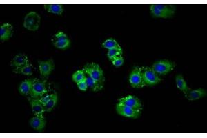 Immunofluorescence staining of HepG2 cells with ABIN7144938 at 1:166, counter-stained with DAPI. (ABCG5 抗体  (AA 1-127))