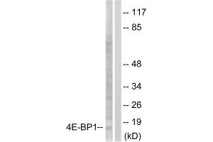 Western blot analysis of extracts from Jurkat cells, treated with Insulin (0. (eIF4EBP1 抗体  (Ser65))