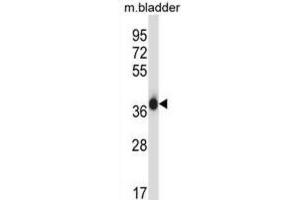 Western Blotting (WB) image for anti-Eukaryotic Translation Initiation Factor 2 Subunit 1 (EIF2S1) antibody (ABIN2997340) (EIF2S1 抗体)