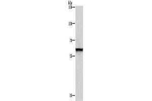 Western Blotting (WB) image for anti-Thyroid Hormone Receptor Interactor 4 (TRIP4) antibody (ABIN2429536) (TRIP4 抗体)