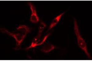ABIN6274177 staining HuvEc cells by IF/ICC. (PFKFB1 抗体  (C-Term))