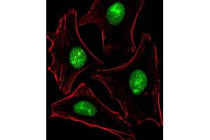 Fluorescent image of Hela cells stained with XAF1 PTK2B Antibody (C-term) (ABIN6243517 and ABIN6577462).