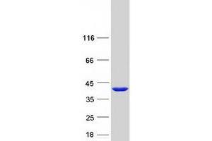 FAM118B Protein (Myc-DYKDDDDK Tag)