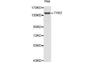 Western blot analysis of extracts of Raji cell lines, using TYK2 antibody. (TYK2 抗体  (AA 750-850))