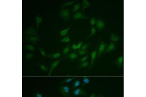 Immunofluorescence analysis of MCF-7 cells using LIG1 Polyclonal Antibody (LIG1 抗体)