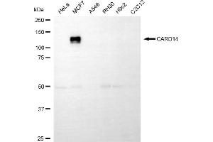 anti-Caspase Recruitment Domain Family, Member 14 (CARD14) antibody