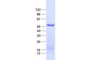 Western Blotting (WB) image for Glial Cells Missing Homolog 1 (GCM1) protein (His tag) (ABIN2721768)
