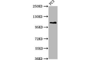 Western Blot Positive WB detected in: PC-3 whole cell lysate All lanes: FAN1 antibody at 5. (FAN1 抗体  (AA 167-373))