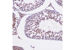 Immunohistochemistry (IHC) image for anti-Tubulin, gamma Complex Associated Protein 6 (TUBGCP6) (AA 600-900) antibody (ABIN7271055)