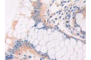Immunohistochemistry (IHC) image for anti-Cat Eye Syndrome Chromosome Region, Candidate 1 (CECR1) (AA 30-511) antibody (ABIN7430045)