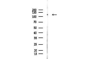 anti-Ubiquitination Factor E4A (UBE4A) (C-Term) antibody