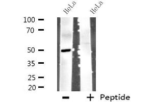 Western blot analysis of extracts from HeLa cells using MYLIP antibody. (MYLIP 抗体  (Internal Region))