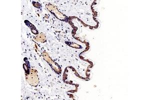 Immunohistochemistry (Paraffin-embedded Sections) (IHC (p)) image for anti-Palladin, Cytoskeletal Associated Protein (PALLD) antibody (ABIN7074976)