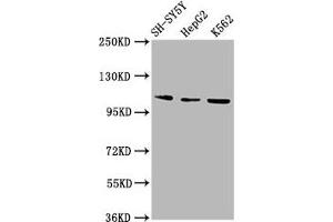 Western Blot Positive WB detected in: SH-SY5Y whole cell lysate, HepG2 whole cell lysate, K562 whole cell lysate All lanes: ULK2 antibody at 2. (ULK2 抗体  (AA 211-276))